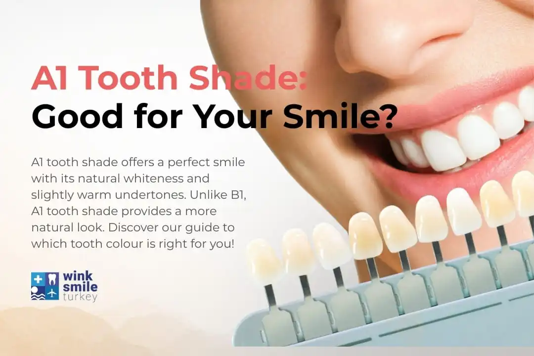 A1 Tooth Shade: Good for Your Smile? Antalya, Turkey