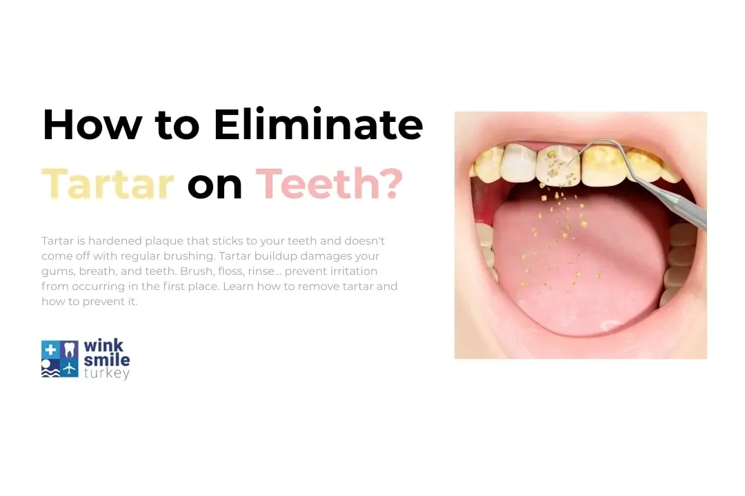 How to Eliminate Tartar on Teeth?