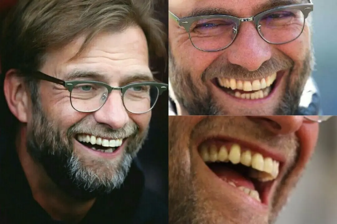 Are there any signs of tooth decay on Jürgen Klopp's teeth?