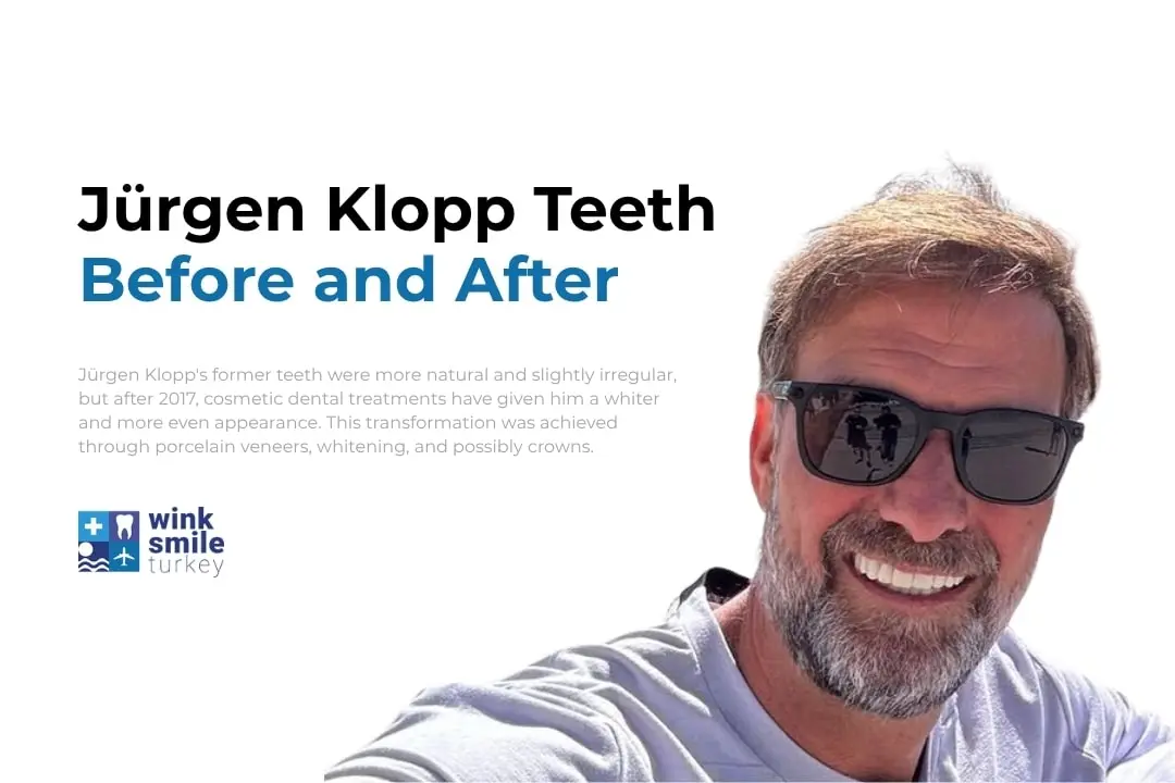 Jürgen Klopp teeth before after