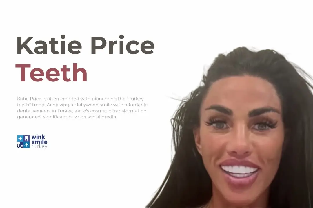 Katie Price teeth