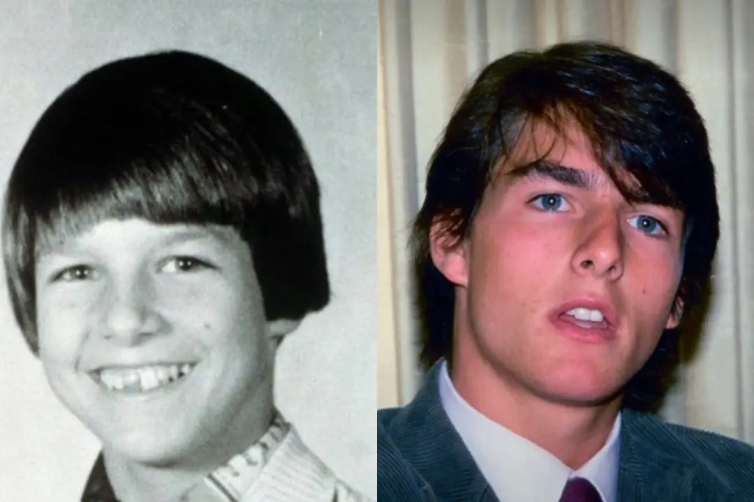 Tom Cruise teeth before after