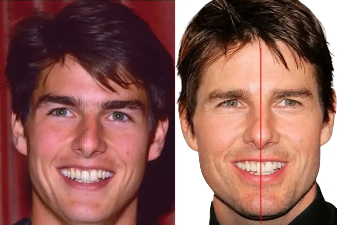 Are Tom Cruise's teeth asymmetrical?