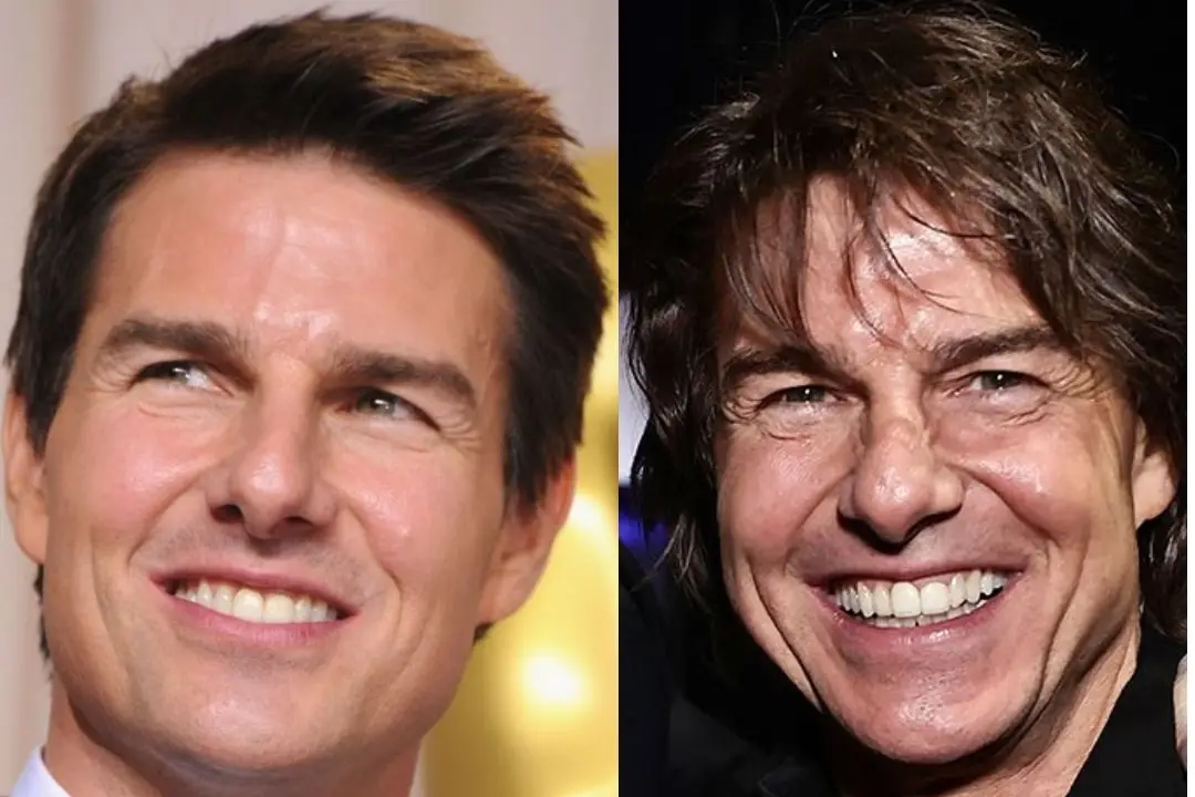 Tom Cruise 3 front teeth