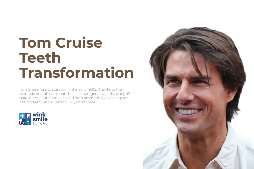 Tom Cruise Teeth Transformation