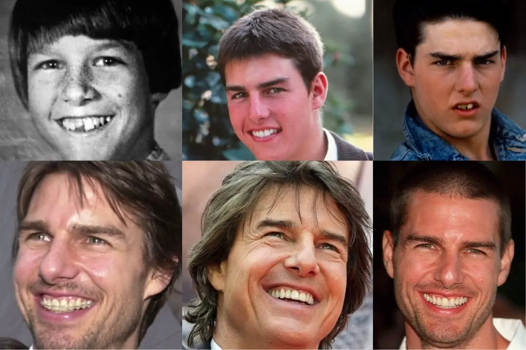 Tom Cruise Teeth