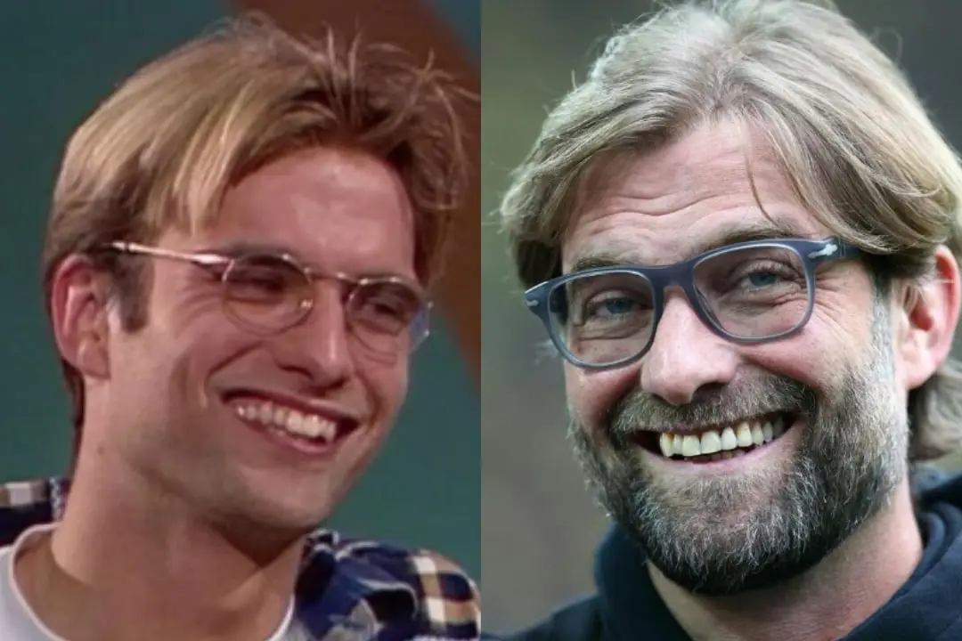 What happened to Jürgen Klopp's teeth?