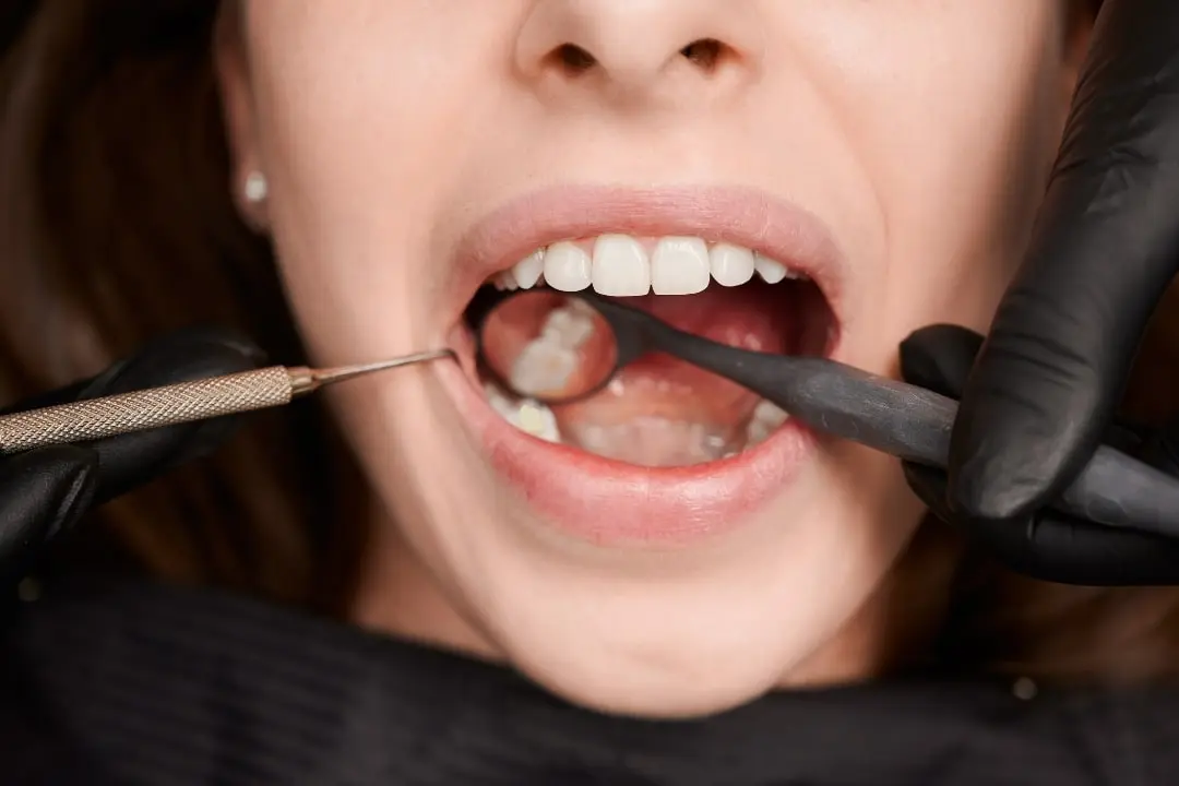Why does my tooth filling hurt after months?