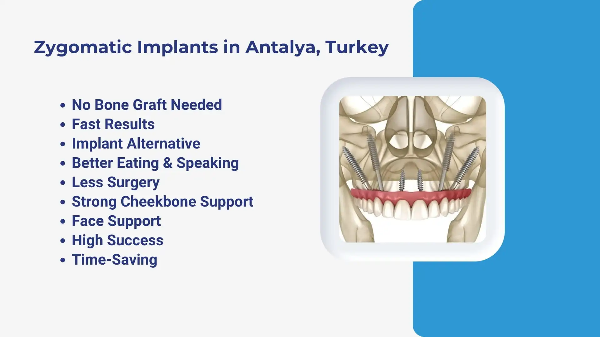 Zygomatic implants in Antalya, Turkey