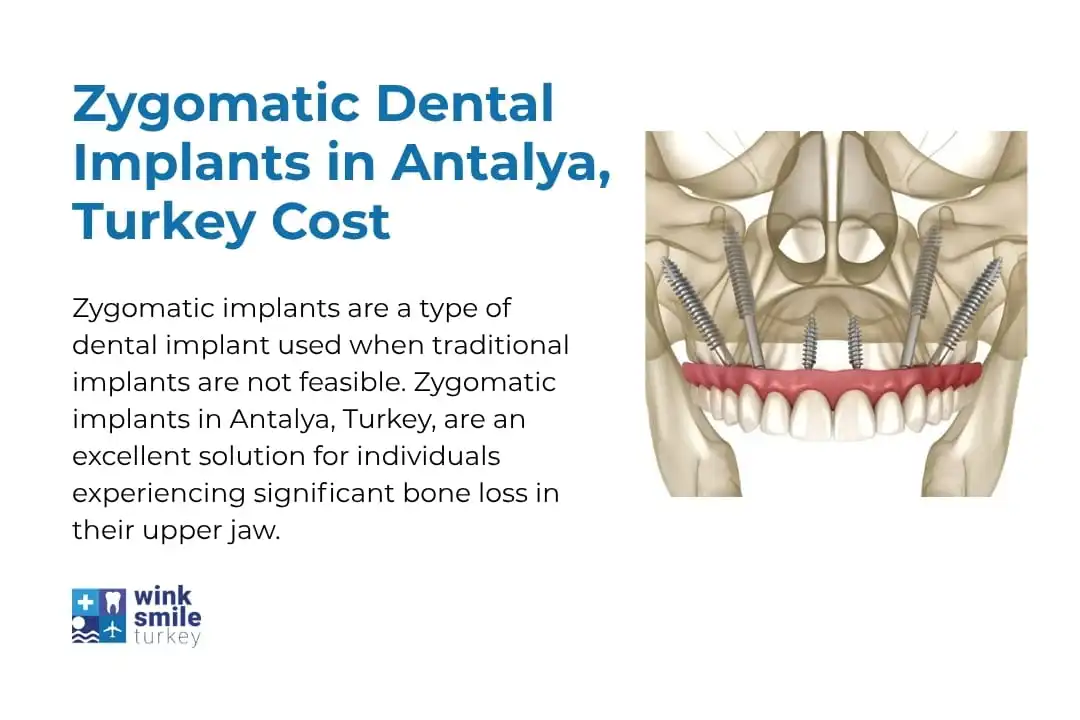 Zygomatic Implants in Antalya, Turkey Cost